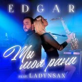 Скачать песню EDGAR, Ladynsax - Ты моя рана